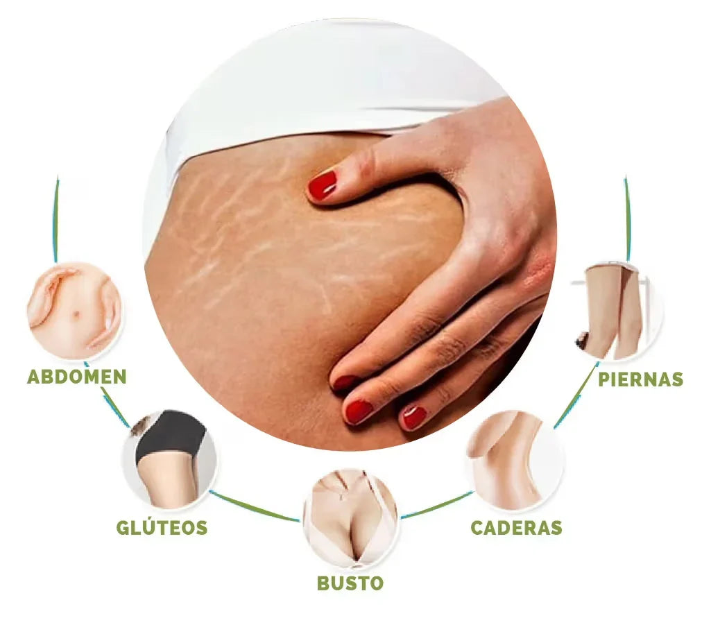 Skinrepair® Mejora la apariencia de tu piel!