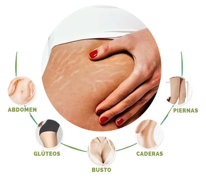 Skinrepair® Mejora la apariencia de tu piel!